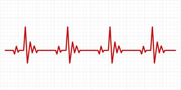 When Should You Get an ECG Test? Early Symptoms and Risk Factors to Know