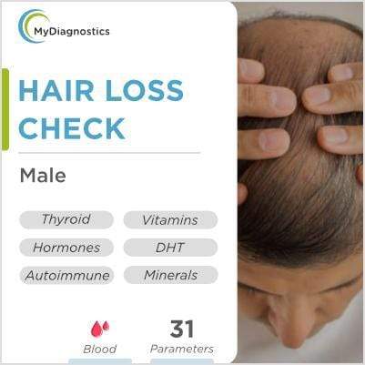 MyDiagnostics DHT Hair Loss Check Comprehensive - Male in Hyderabad