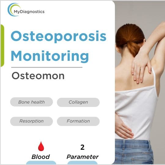 MyDiagnostics Osteoporosis Bone Health Monitoring Test at home